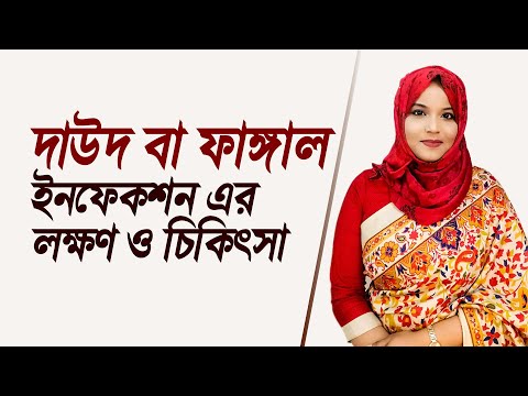 ভিডিও: নাস্ট্যাটিন কি দাদ জন্য ভালো?