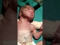 Bad condition Newborn baby after birth#shortsfeed#viral