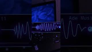 DJ MENINA DO JOB JJ KANE BY APRI REMIX FULL BASS VIRAL TIK TOK 2025