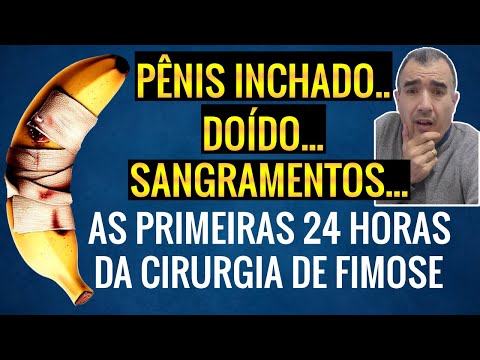 As primeiras 24 hs após realizar a cirurgia de fimose