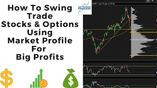 How To Swing Trade Stocks And Options Using Market Profile?