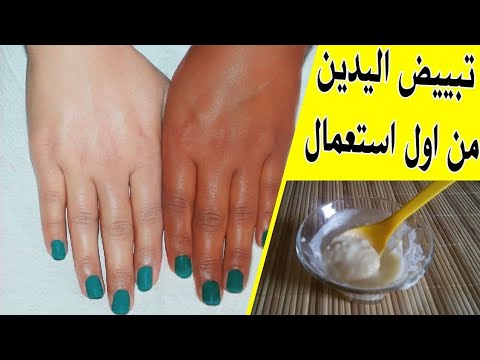 حولت منظر ايدي بأسرع وصفه سحرية جدتي نصحتني بيها
