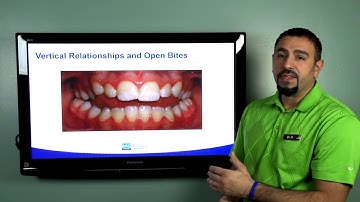 What Is An Open Bite?