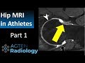 MRI of hip injuries in Athletes - Part 1