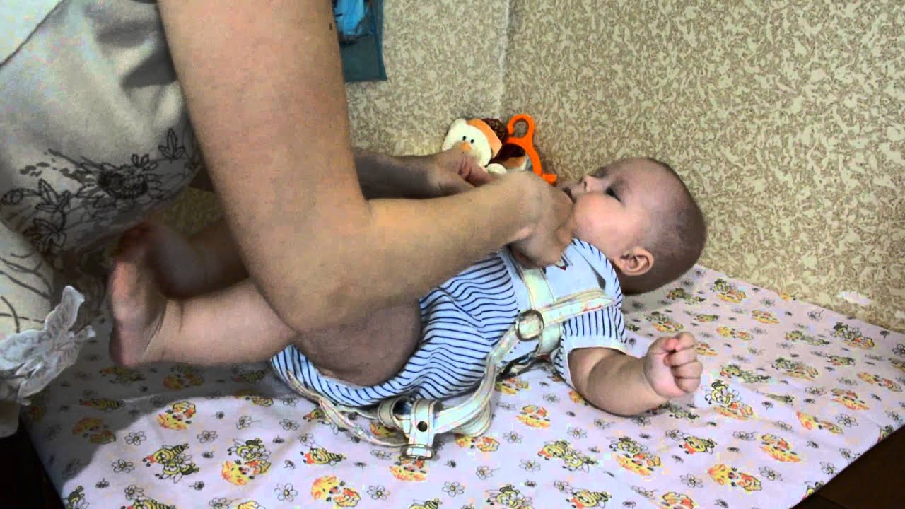 Как надевать стремена Павлика. Дисплазия тазобедренного сустава - YouTube