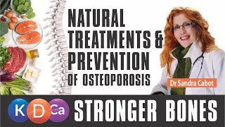 Osteoporosis Treatment | Prevent Osteoporosis Naturally | Bone Density Best Foods for Stronger Bones