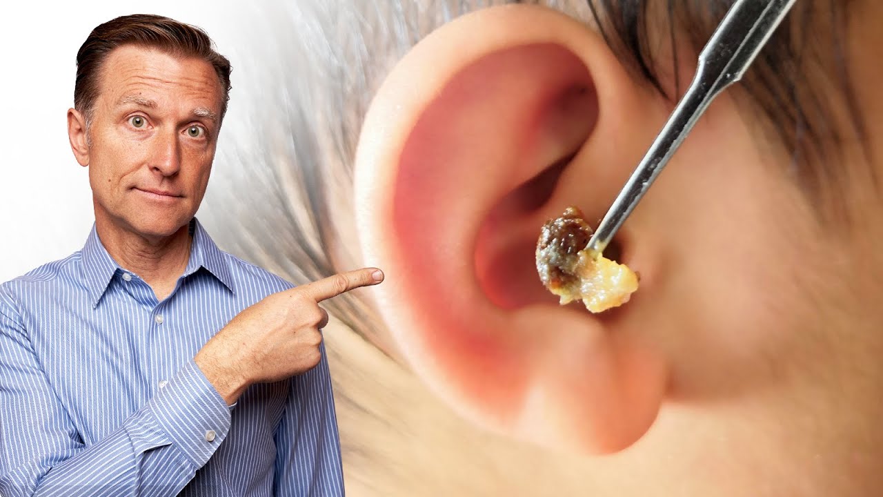 What Does LOTS of EARWAX Buildup Mean?￼