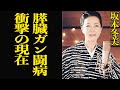 坂本冬美が膵臓癌の壮絶闘病生活を告白...日本を代表する演歌歌手に余命宣告をされたと言われる噂の真相に思わず沈黙...!老体に鞭打つ現在の姿に驚きを隠せない【芸能】