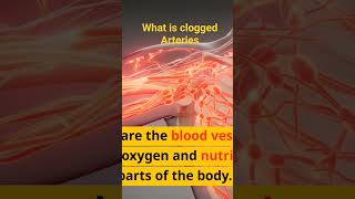 What is clogged arteries? #shorts #heartdisease #cloggedarteries