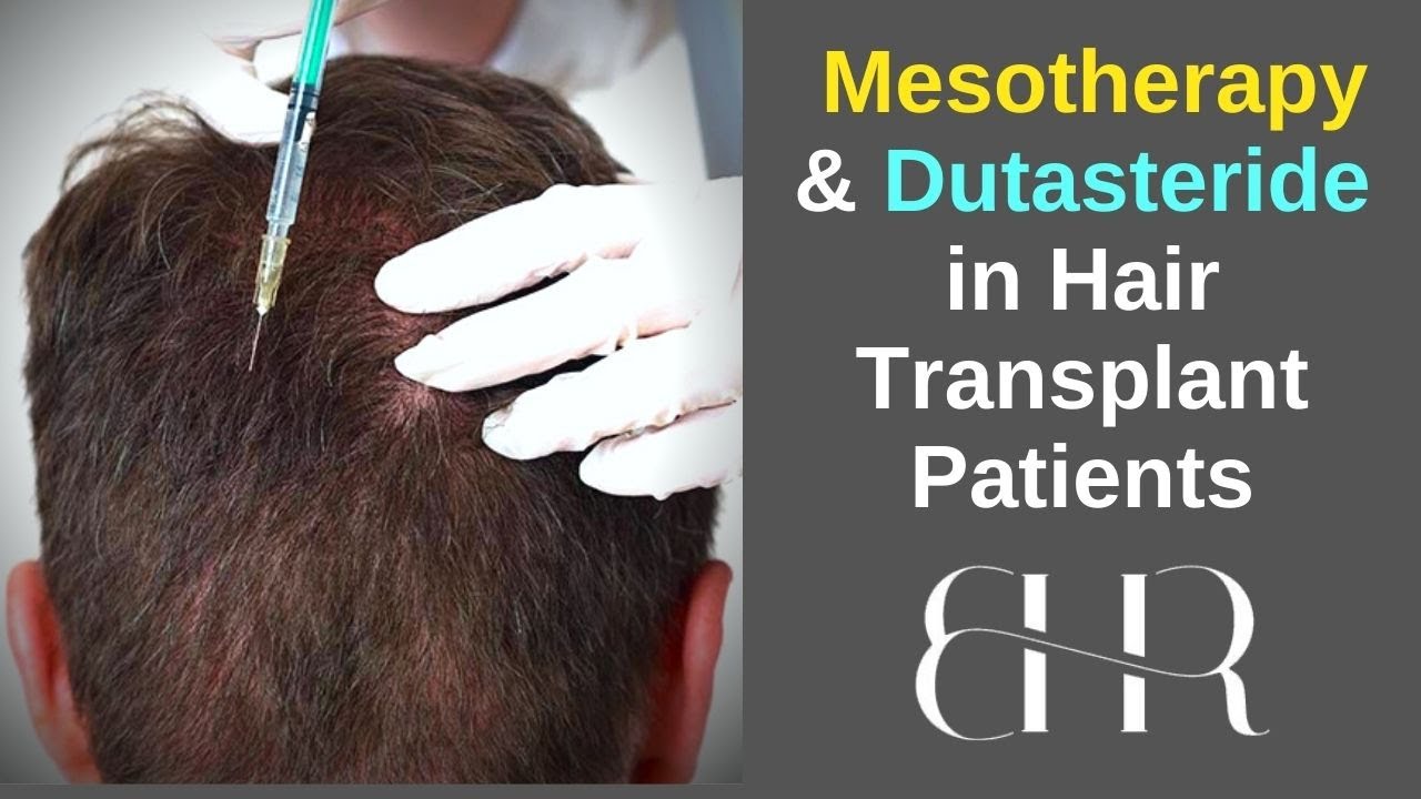 Hair Loss Prevention  Treatment Using Hair Mesotherapy  DermaHealth