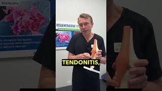Say Goodbye to Patellar Tendonitis Pain Today