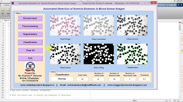 Matlab Code for Anemia Detection in Blood Smear Images Using Image Processing