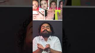 Issues of geneticle disorder due to cousin marriage | #arab #marriage #genetics #disorders #shorts