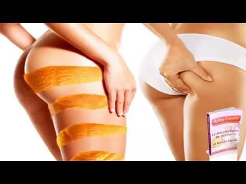 Adios Celulitis | Evita 4 alimentos para decirle adiós a la celulitis