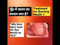 तीखा या मसालेदार खाने से मुंह में जलन का उपचार ! How to Treat Mouth Burning from Spicy Foods !