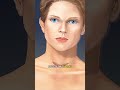 Surgery Through Your MOUTH? 🇱🇷 🤯 No Neck Scar!
