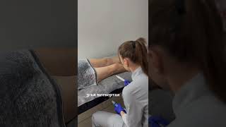 Артроз коленного сустава