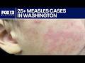 Measles cases spike in Washington, across U.S. | FOX 13 Seattle