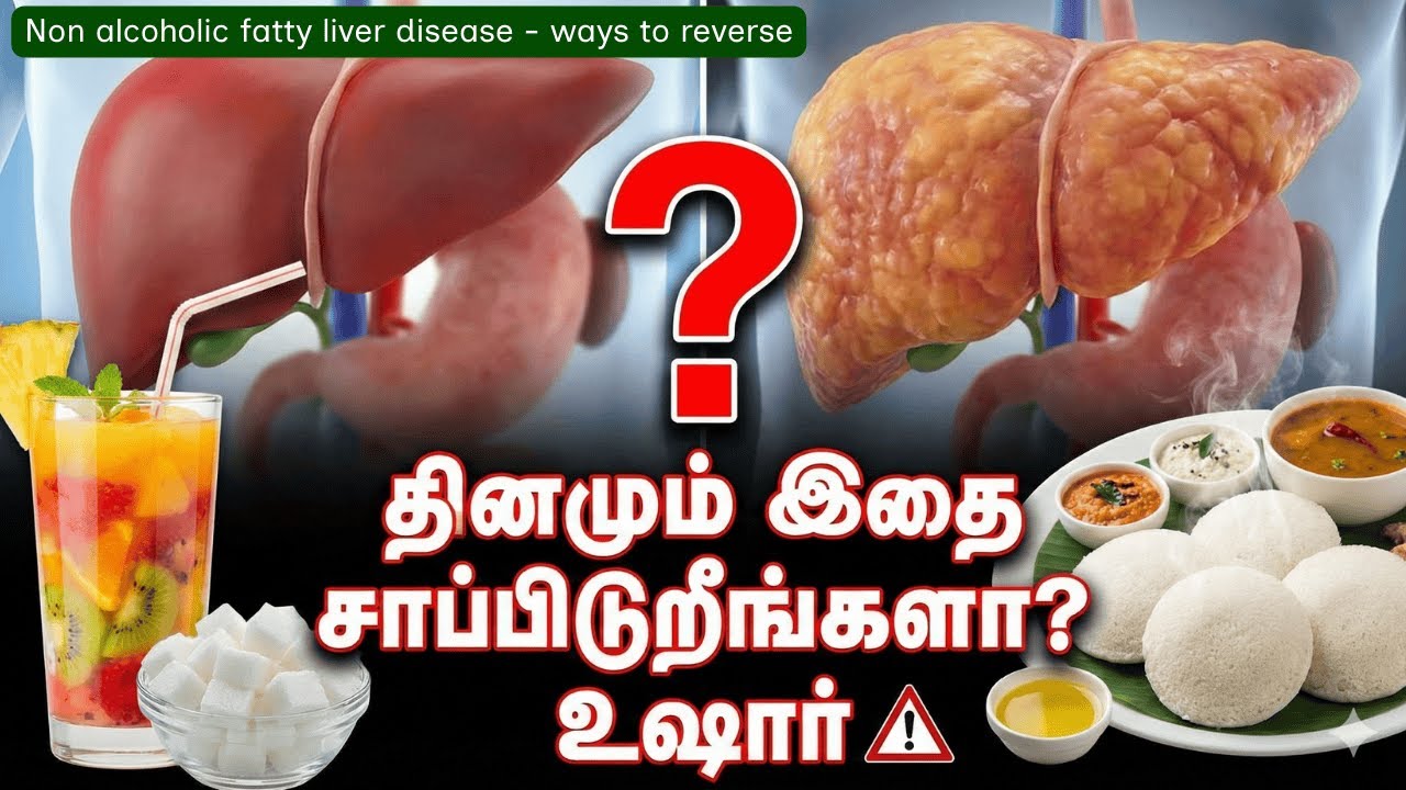 ஆரோக்கியம்னு நெனச்சு தினமும் இத சாப்பிடுறீங்களா? 😱 (Fatty Liver Warning)- கல்லீரல் | silent killers