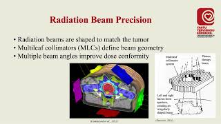 Accuracy in radiotherapy