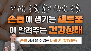 손톱 세로줄이 나타나는 이유는?