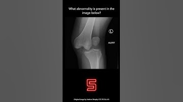 Musculoskeletal X-ray Question 2