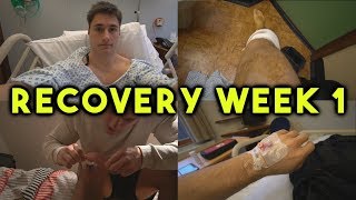 Knee Surgery and Recovery Week 1 - Getting Back to Training Quickly