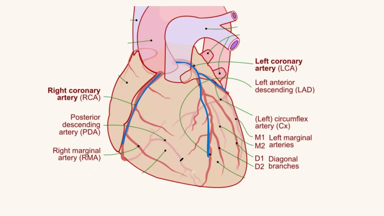 10.EKG: FROHI- određivanje ishemije/infarkta
