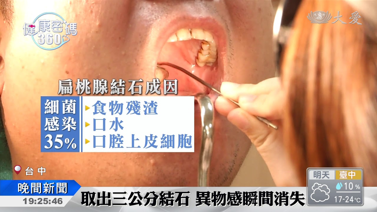 喉嚨卡卡的原因竟然是 Youtube 喉嚨卡卡的原因竟然是 Youtube