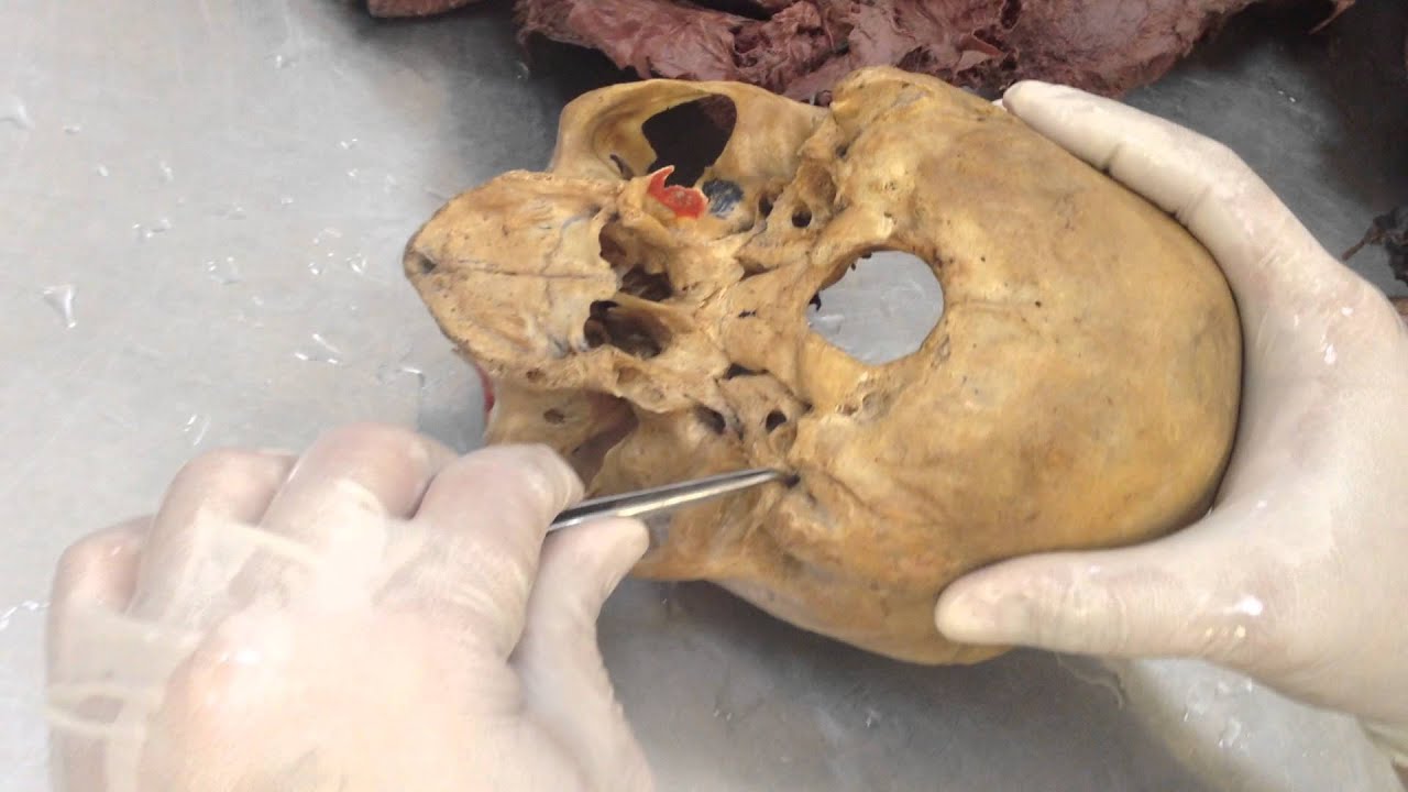 Anatomy Skull Revision - YouTube
