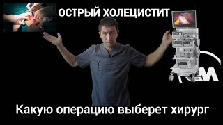 Острый холецистит. ЛХЭ или открытая холецистэктомия.