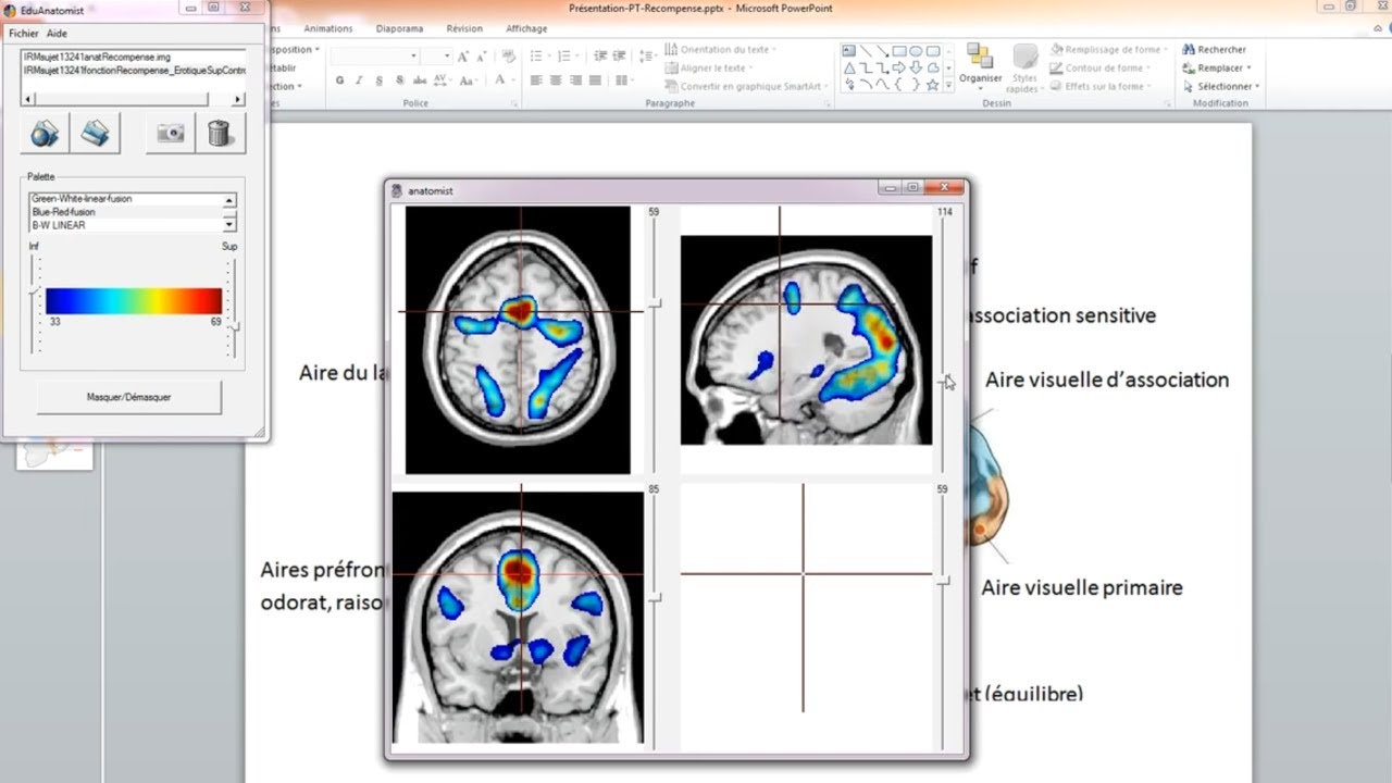[eSVT] Circuit de la récompense et le déclenchement du plaisir