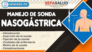 ¿Qué es una sonda nasogástrica y para qué sirve?