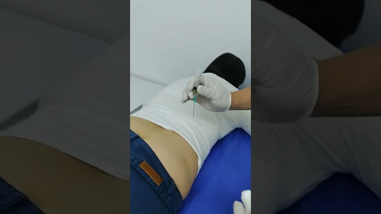 procedimiento inyectologia