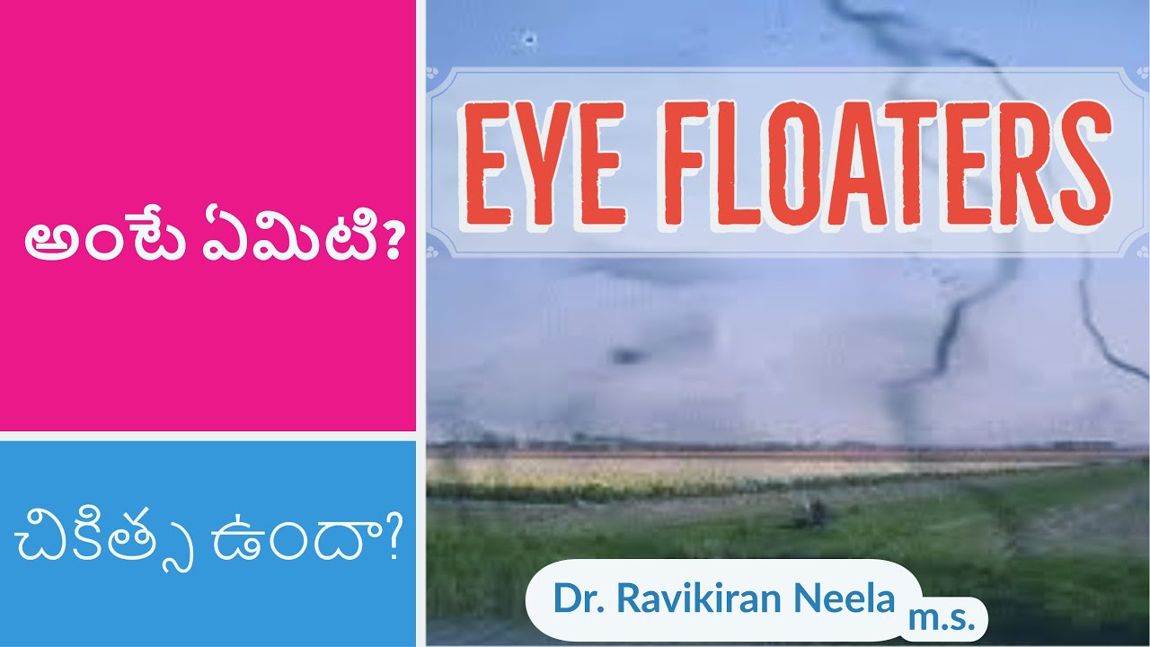 Facts about Eye floaters (దృష్టి లోని నల్ల మచ్చలు ) by Dr. Ravikiran Neela - YouTube