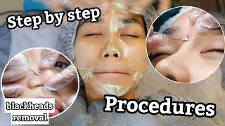 I TRIED DIAMOND PEEL with BLACKHEADS REMOVAL screenshot 4