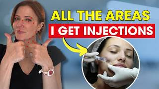 Exactly Where I Get My Injections and Why | Botox & Filler Placement | Dr. Mary Alice Mina