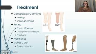 EXS 486 Lower Limb Amputation