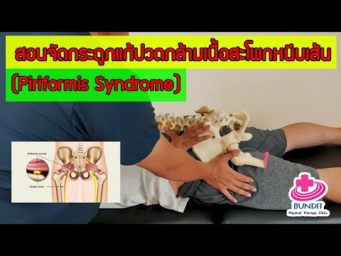 วีดีโอ: 3 วิธีในการเอาชนะ Piriformis Syndrome