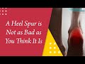 A Heel Spur is Not as Bad as You Think It Is!