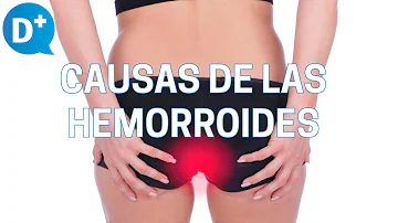 ¿Cuándo hay que preocuparse por las hemorroides?