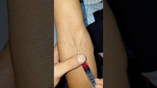 IV injections kase lagaye..🩺💉 #cannula #doctor #hospital #medicalstore #hospitallife #nursing