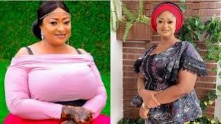 Fans And Colleagues Were Shocked At Actress Ronke Oshodi Oke As She Loses Big Bbs