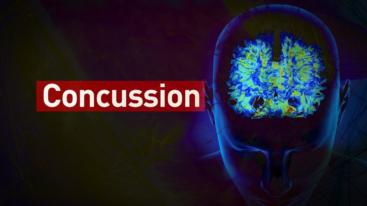 Q&A: Living with concussion