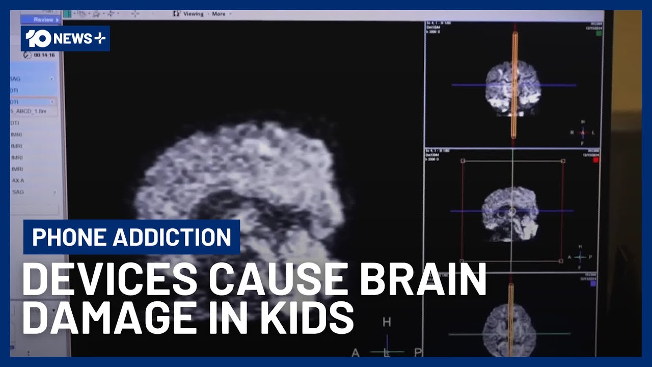 Chilling Warning For Parents As MRI Scans Show Phones Are Damaging Kids' Brains | 10 News+