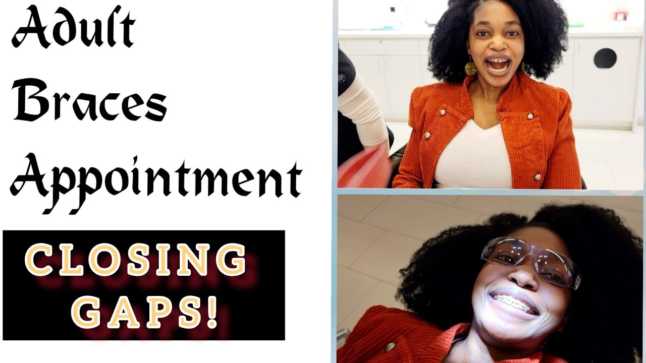 Trip To My Orthodontics Appointment Adult Braces braces teethcare 