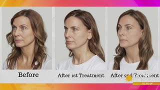 How Regenerative Aesthetics Is Changing The Way We Age