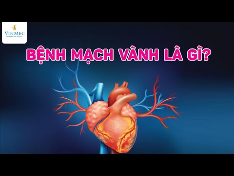 Video: Vữa - nó là gì?