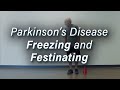 Parkinsons disease freezing  festinating gait