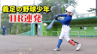 義足の野球少年がすごい！美しいスイングでHR連発。